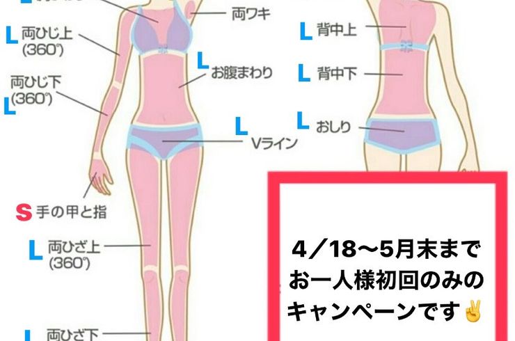 脱毛.大村市脱毛.長崎脱毛.顔脱毛.大村市エステ.癒し空間Yufla〜ゆふら〜